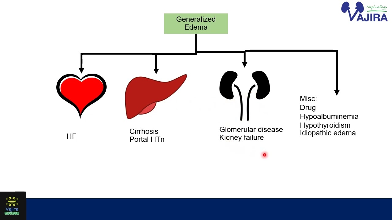 Approach to Edema