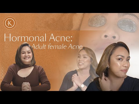 Hormonal Acne