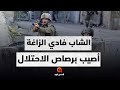 الشاب فادي الزاغة يروي تفاصيل إصابته أثناء قيادته لدراجته خلال عدوان الاحتلال على مدينة نابلس