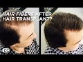 This is what a Hair Transplant Patient feels after Hair Fibers...