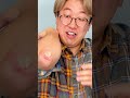 【ドッキリ】干し梅をかさぶたっぽく加工して食べてみたw