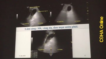 SIÊU ÂM CHẨN ĐOÁN ĐAU BỤNG CẤP Bs. Nguyễn Quang Trọng