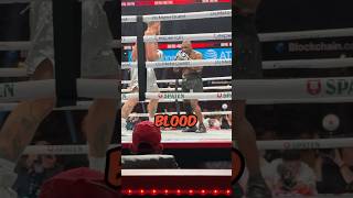 Thumbnail for Mike Tyson Reveals Why He Won Against Jake Paul