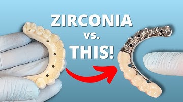 THE BEST Option | All On 4 Zirconia vs. Titanium Frame With Individual Crowns