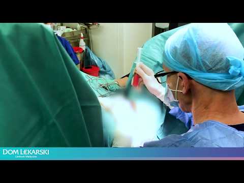 Wideo: Chirurdzy Wykonują Kobiecie Pochwę Z Rybiej Skóry