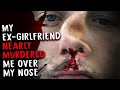 My ex-girlfriend nearly murdered me over my nose