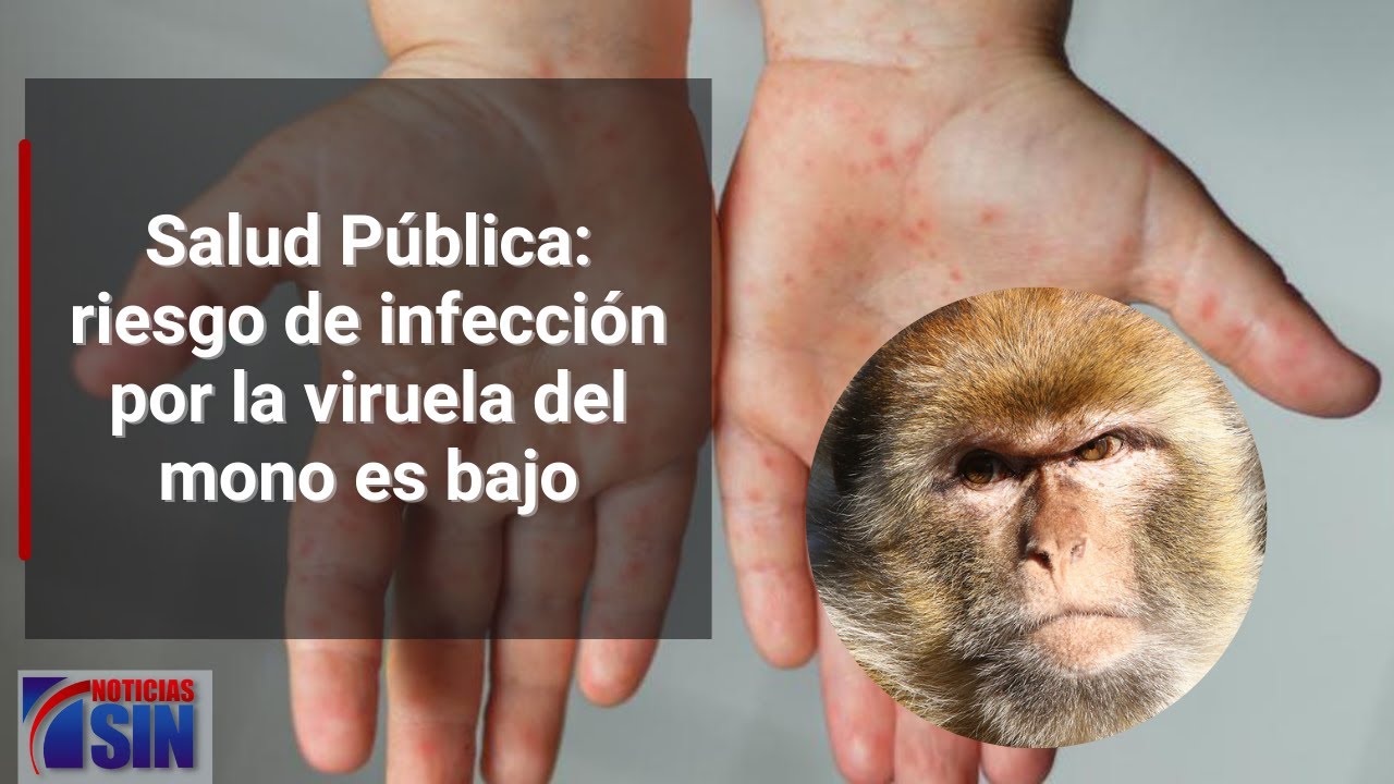 Que tomar para la infeccion de muela