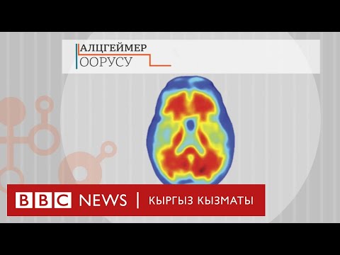 Альцгеймер оорусу менен алпурушкан дары пайда болду  - BBC Kyrgyz