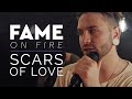 Fame On Fire - Scars Of Love (Official Music Video)
