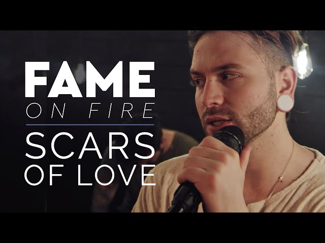 Fame On Fire Scars Of Love Lyrics Genius Lyrics Fame On Fire Scars Of Love Lyrics Genius Lyrics