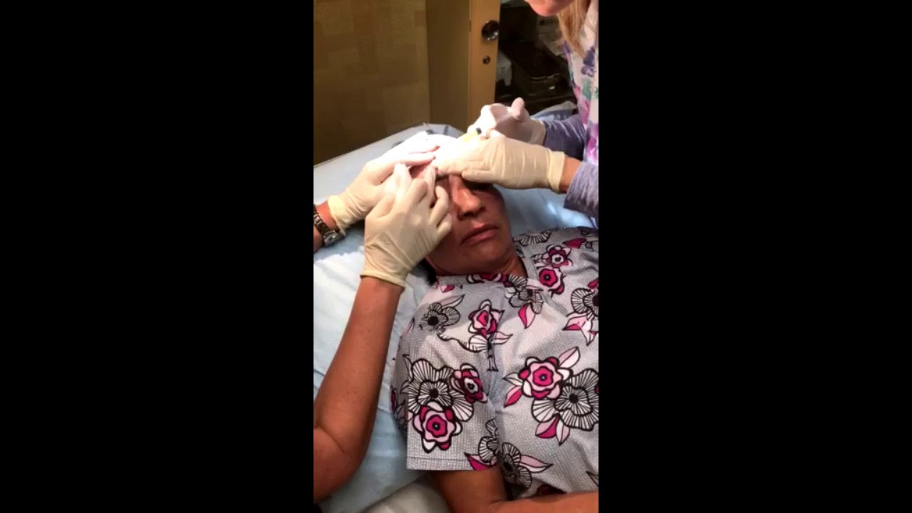 Facial rejuvenation at the doctors clinic amarillo tx youtube