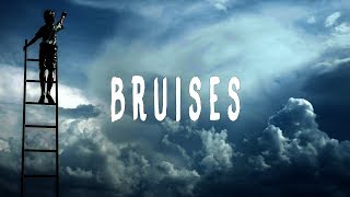 Lewis Capaldi - Bruises (Lyrics)