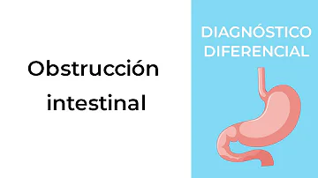 ¿Cuál es la causa más frecuente de obstrucción intestinal?