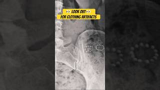 Clothing Artifacts on X-Ray #shorts #xray #radiology