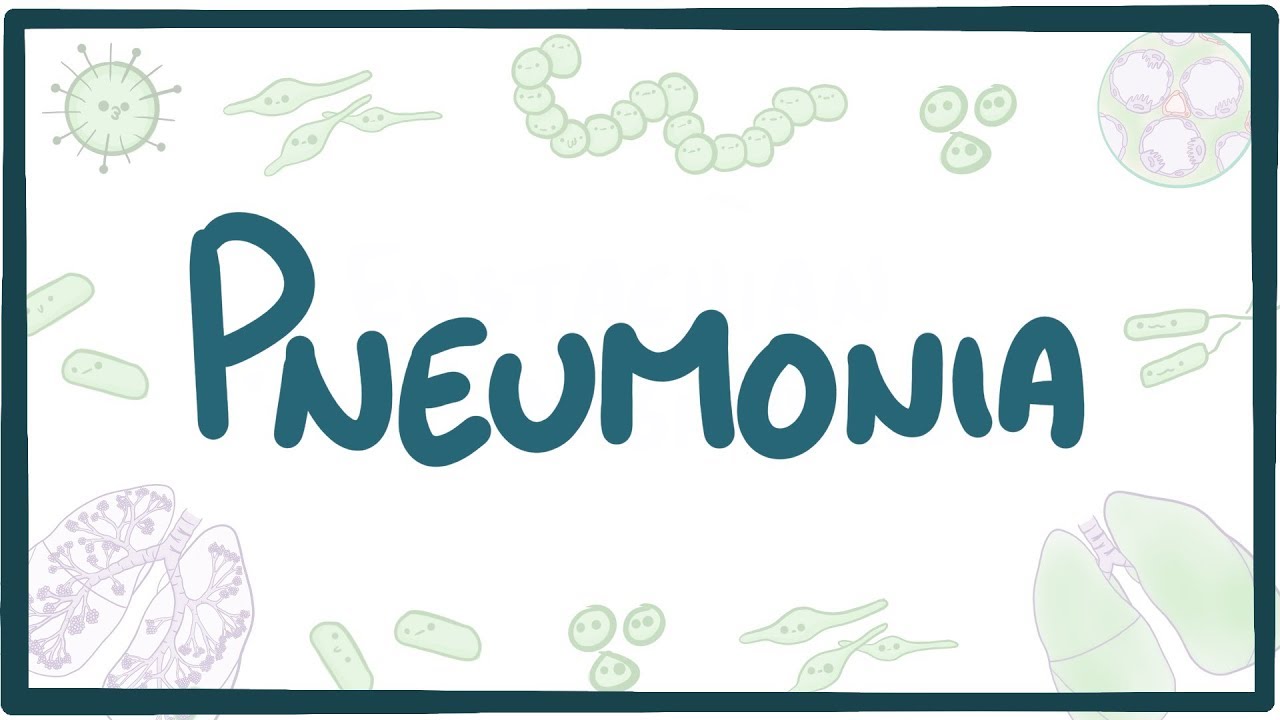 Pneumonia   causes symptoms diagnosis treatment pathology