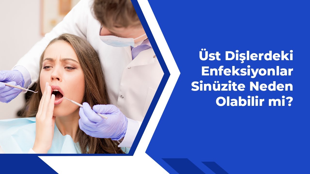 Üst Dişlerdeki Enfeksiyonlar Sinüzite Neden Olabilir mi?