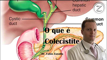 O que causa a colecistectomia?