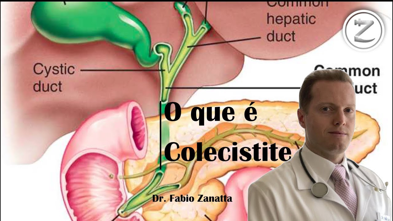 39- O que é Colecistite (Pedra na Vesícula Biliar) - YouTube