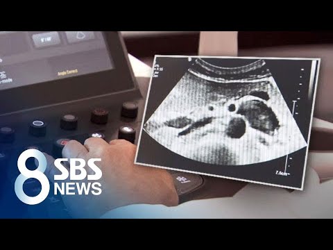 <strong>원인</strong> 모를 <strong>혈뇨</strong>, &amp;#39;호두까기 증후군&amp;#39; 의심해 보세요 / SBS