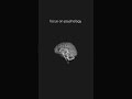 Trading is a game of probabilities - Master the mindset #Tradingmindset #daytrading #riskmanagement