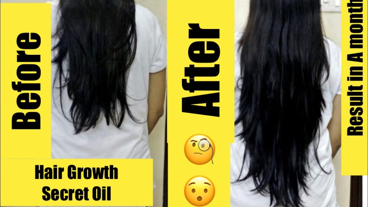 Faster Hair Growth Oil with guaranteed result || Best Oil for long ...