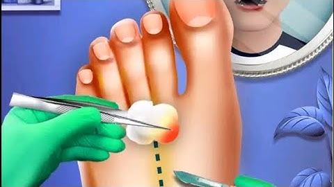 ASMR Foot Doctor Surgery Games|Full Lvl Gameplay