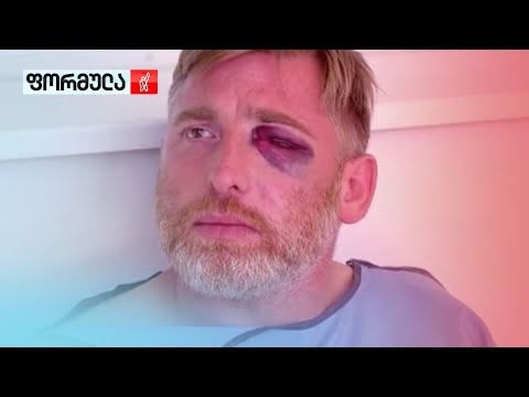 რა წერია ექსპერტიზის დასკვნაში