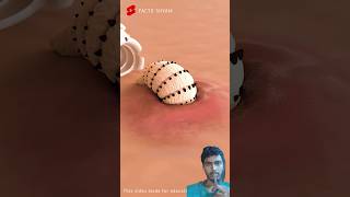 एक मच्छर से शरीर में पलने लगा कीड़ा ! #facts #3danimation #shorts #localstarbinit