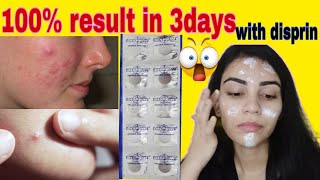 Disprin Face Pack For Treat Acne&Pimples Overnight Clear Skin In 3Days No Scars Honest Guide.