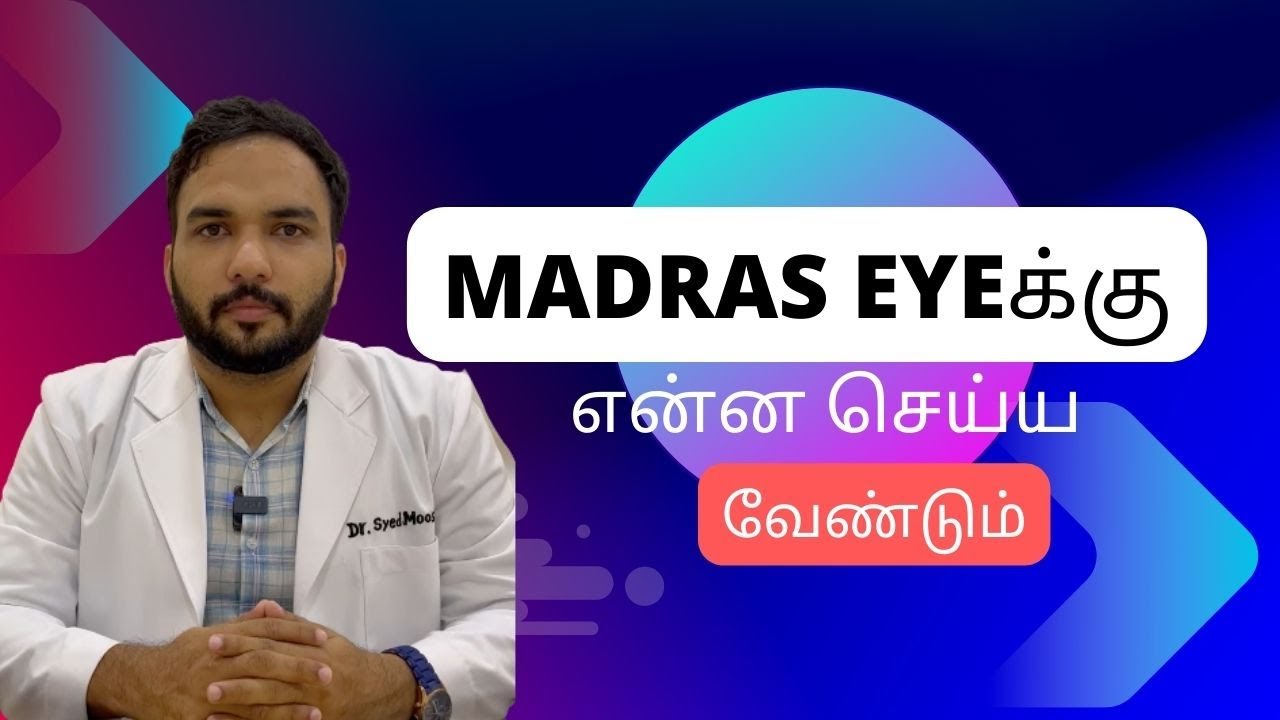 What should you do for Madras Eye? Tamil Dr. Syed Moosa Eye