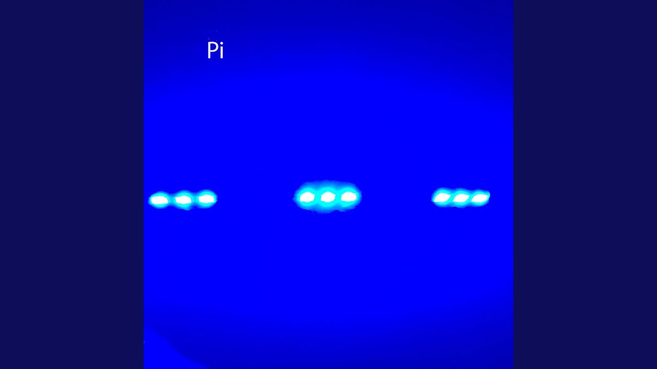 Watch Multiple on YouTube Watch Multiple on YouTube