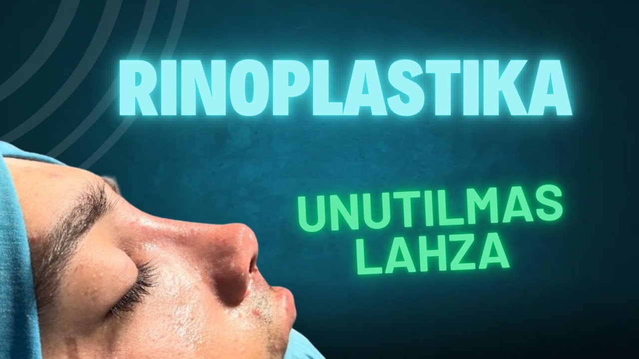 Rinoplastika (Ринопластика) в Алмалыке 944047117 Аскарбек Нуруллаев