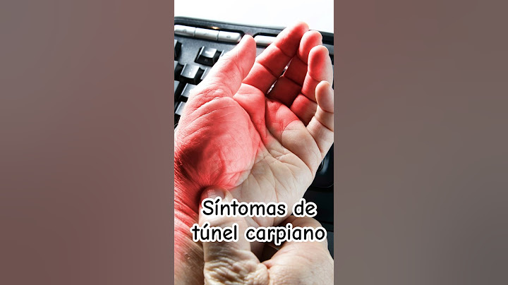 ¡No ignores estas señales de síndrome de túnel carpiano! | Dr. William Guerrero. #medicina #shorts