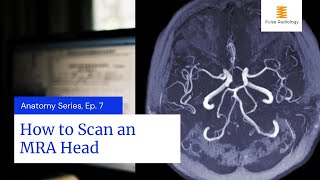 How to Scan an MRA Head