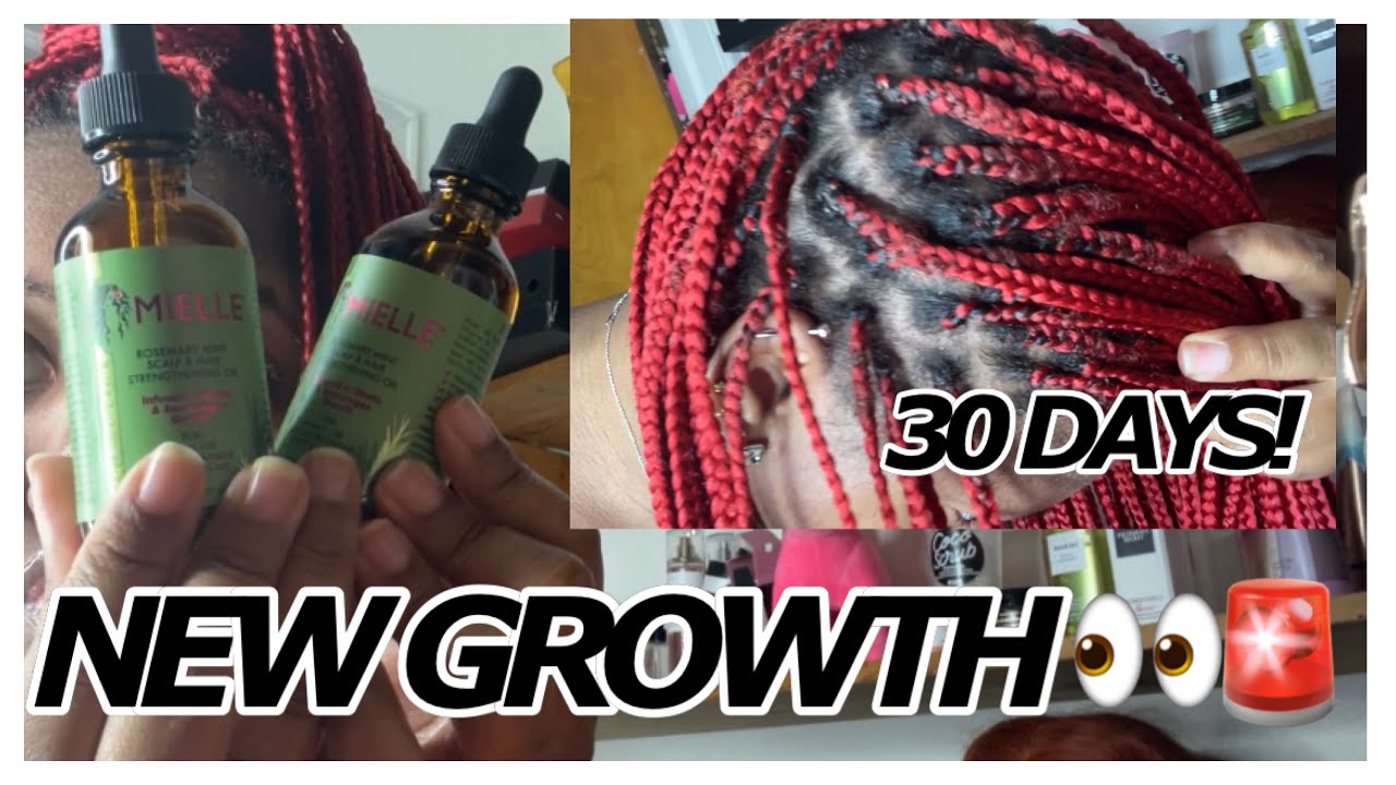 THE TRUTH ABOUT MIELLE ORGANICS ROSEMARY MINT OIL! REAL RESULTS - YouTube