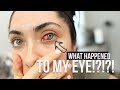 About my pterygium surgery...| surfer's eye | Melissa Alatorre