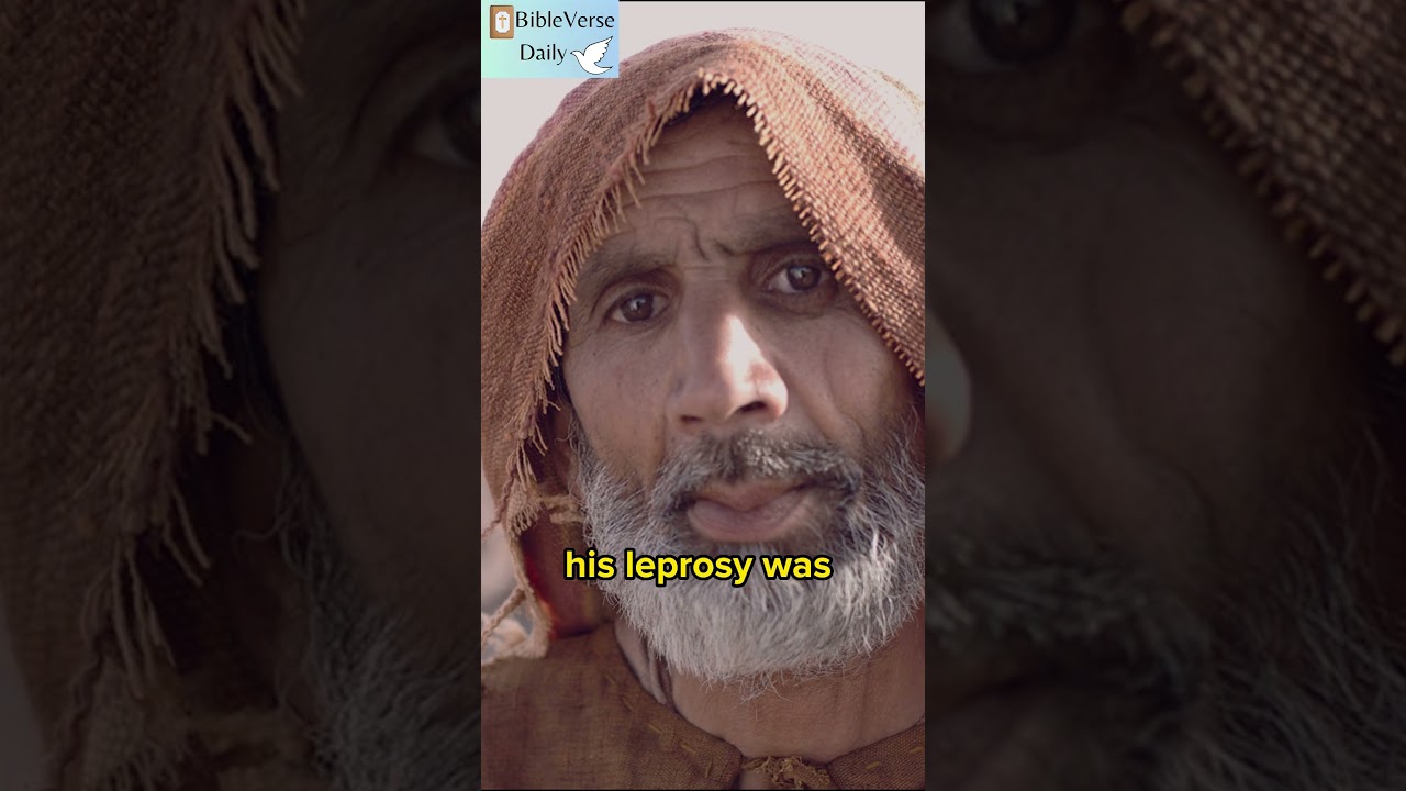 Jesus Cleanse the Leper. 