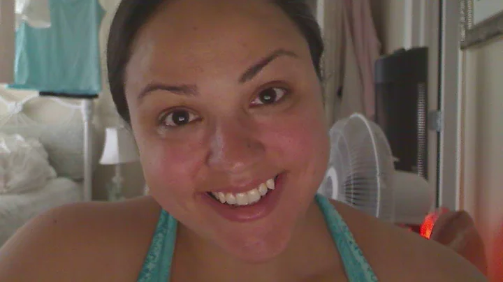 7 months post diagnosis w/o Chemo and Radiation