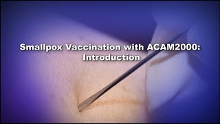Chapter 1: Smallpox Vaccination with ACAM2000: Introduction