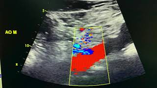 Case study - AAA