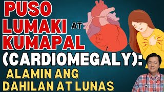 Puso Lumaki at Kumapal (Cardiomegaly): - By Doc Willie Ong (Internist and Cardiologist)