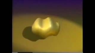how to -Actually- turn a sphere inside out