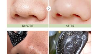 Easy Way To Remove Blackheads From Nose At Home Remedies Priya Creations