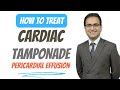 Pericardial Effusion (Cardiac Tamponade) Medicine Lecture on Treatment, Pathology, USMLE NEETPG