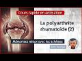 La Polyarthrite Rhumatoïde Partie 2