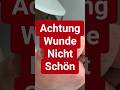 Wundheilung in vier Wochen ￼