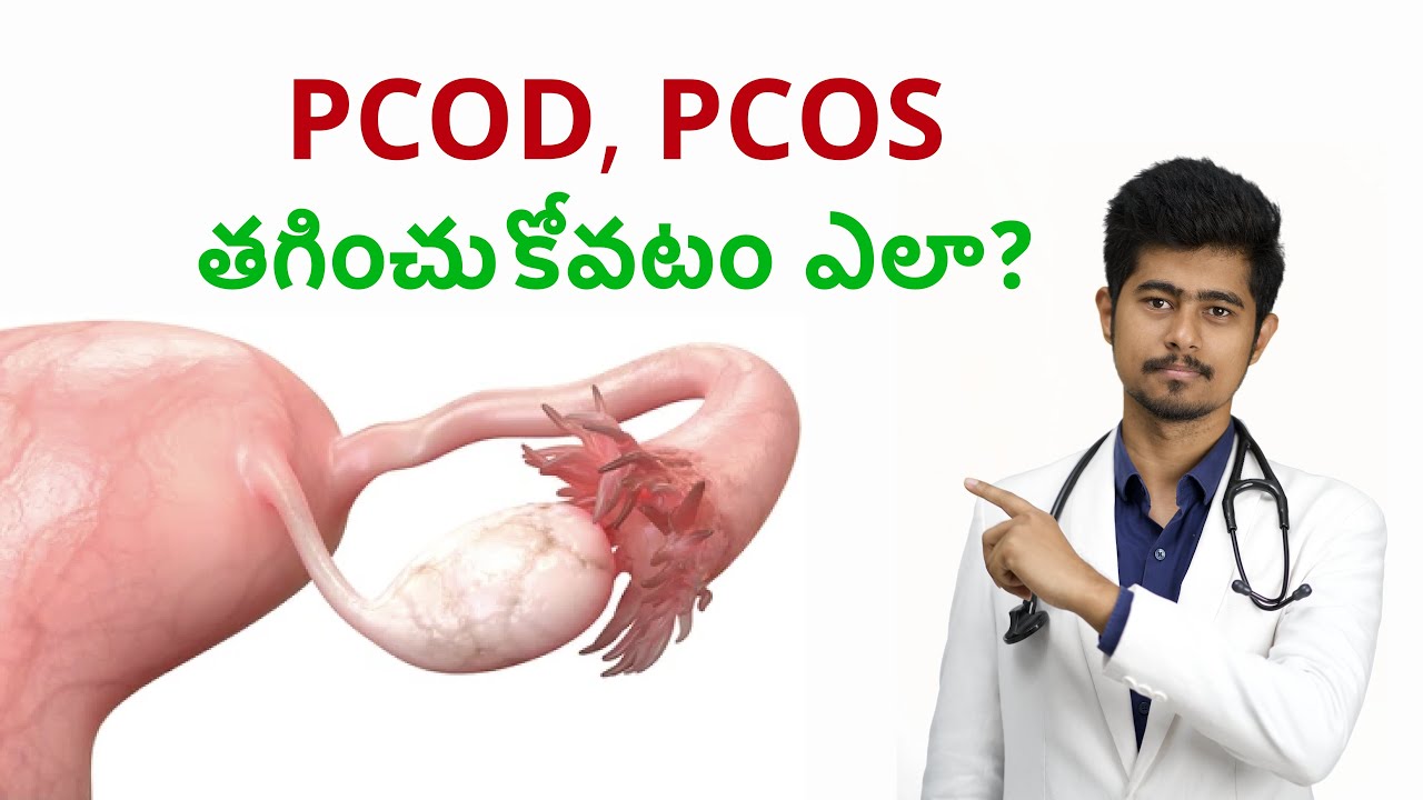 Cure PCOS / PCOD Naturally at Home, Without Tablets! - YouTube