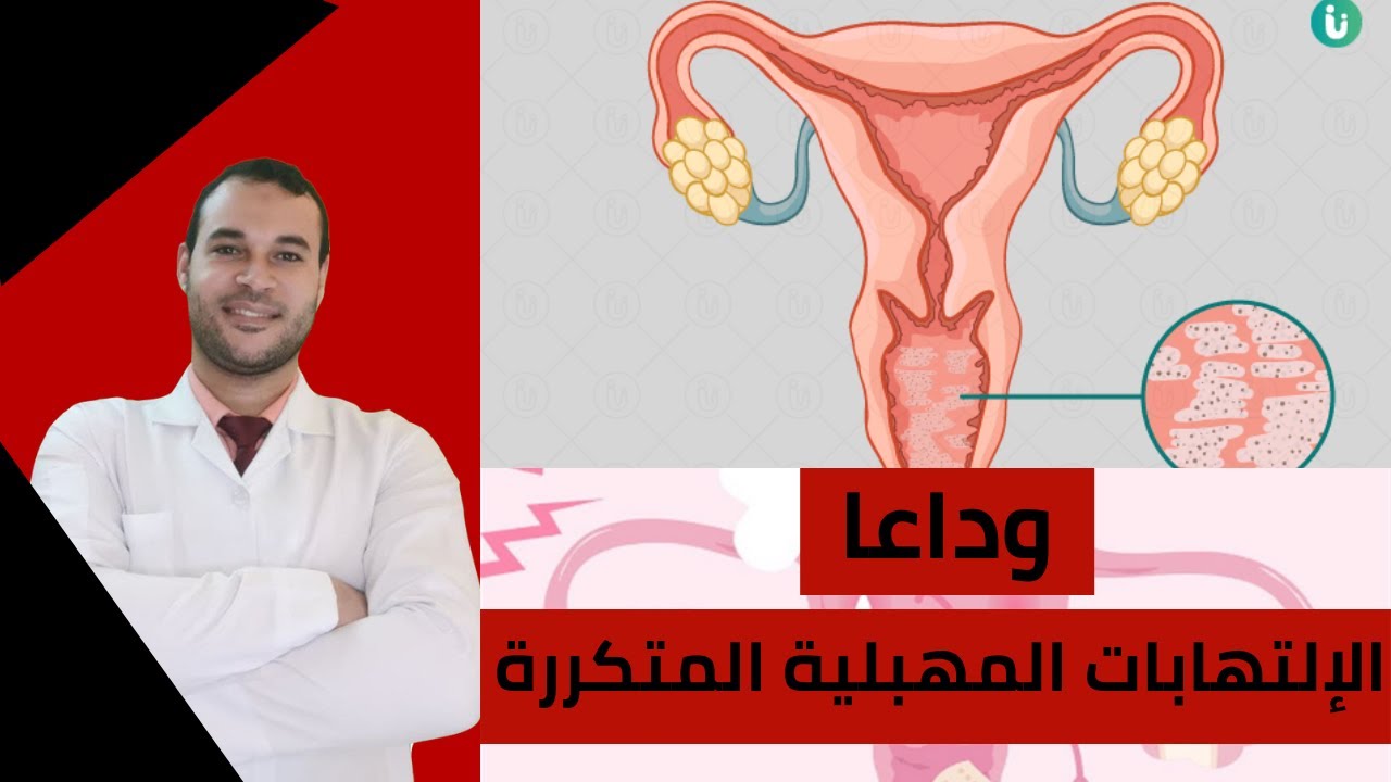 الإلتهابات المهبلية: الأسباب والأعراض والعلاج والوقاية