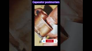 capacitor postmortem #arun #experiment #trending #science #shorts #yosho #viral #india
