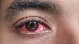 Minecraft Hack Client Tutorial  Coding (ClickGUI + EventSystem) (GER)